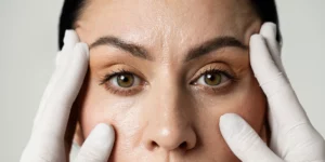 Zabieg plastyki powiek dolnych i górnych w klinice Re Vitae