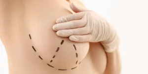 Zabieg powiększania w klinice Re Vitae