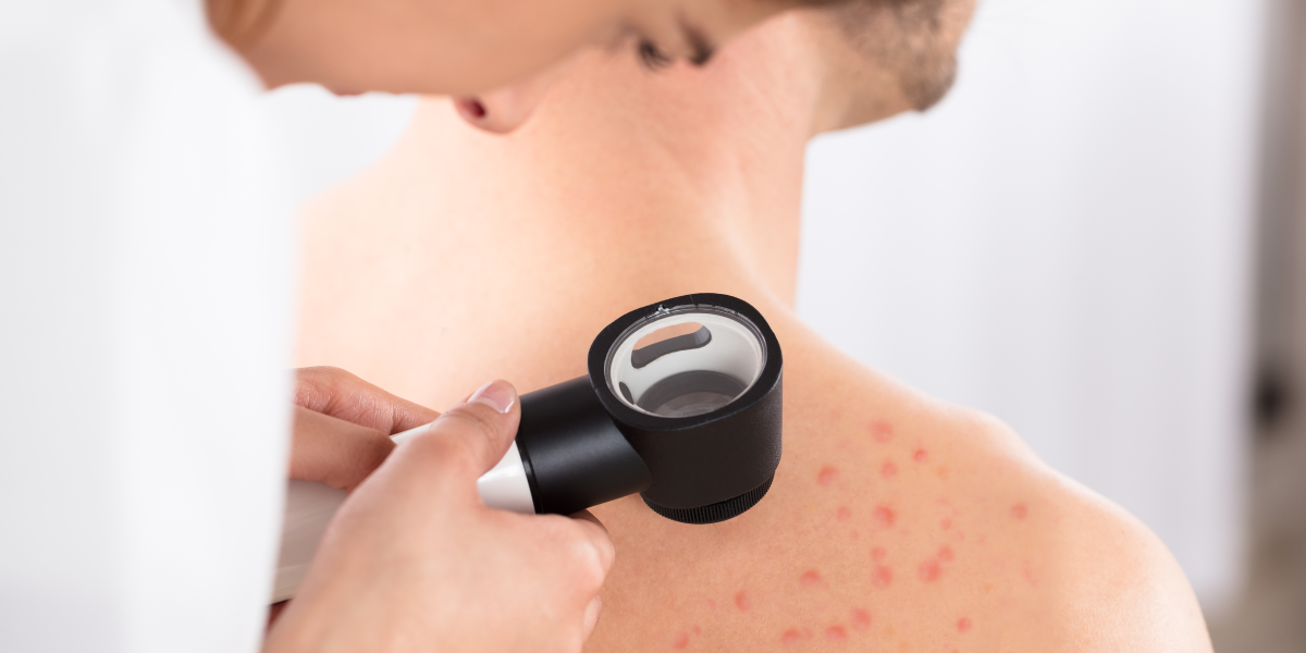 Badanie dermatologiczne z użyciem dermatoskopu w klinice Re Vitae