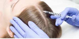 Zabieg z użyciem polinukleotydów na skórę głowy w klinice Re Vitae