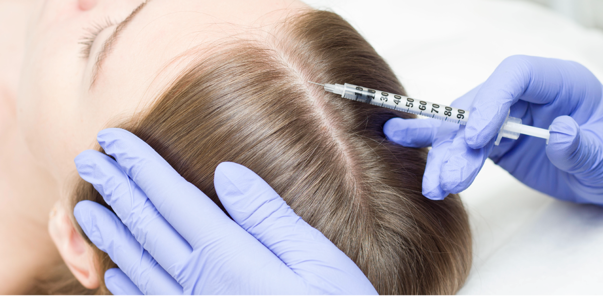Zabieg z użyciem polinukleotydów na skórę głowy w klinice Re Vitae
