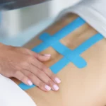 Kinesiotaping po zabiegach chirurgicznych