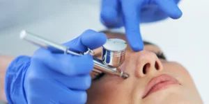 Infuzja tlenowa skóry w klinice Re Vitae Kielce