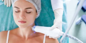 Vivace – radiofrekwencja mikroigłowa twarzy i szyi w klinice Re Vitae Kielce