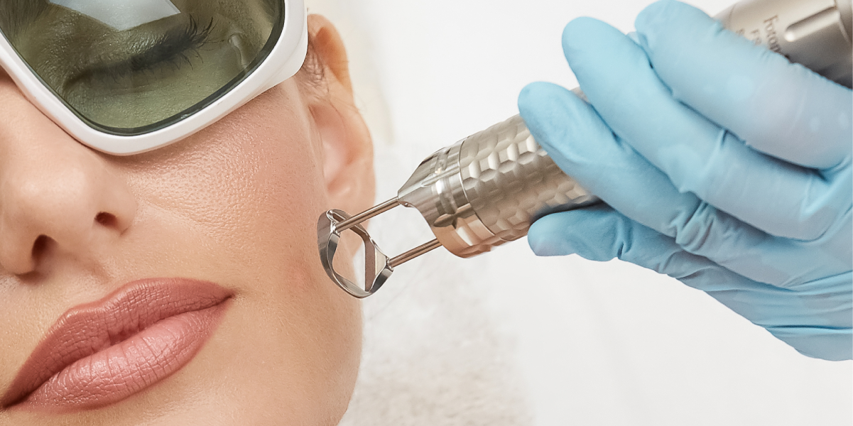 Laseroterapia CO₂ frakcyjna w klinice Re Vitae Kielce