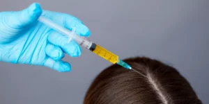 Zabieg osocza bogatopłytkowego na skórę głowy – regeneracja i wzmocnienie cebulek włosów w Re Vitae Kielce