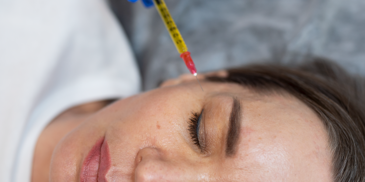 Zabieg osocza bogatopłytkowego na twarz, szyję i dekolt – naturalna regeneracja skóry w Re Vitae Kielce