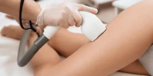 Depilacja laserowa ud z kolanami w klinice Re Vitae Kielce