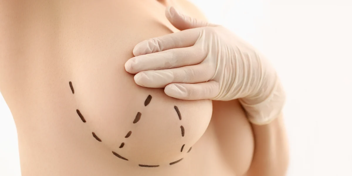 Zabieg powiększania w klinice Re Vitae