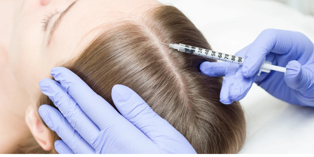 Zabieg z użyciem polinukleotydów na skórę głowy w klinice Re Vitae