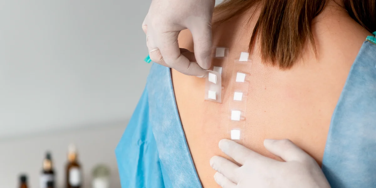 Przeprowadzanie testów płatkowych w klinice Re Vitae