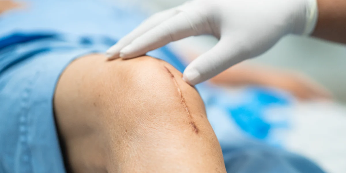 Zabieg z użyciem tropokolagenu w klinice Re Vitae