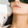 Depilacja laserowa brody w klinice Re Vitae Kielce