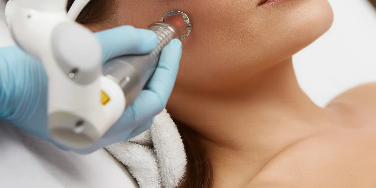 Laser frakcyjny CO₂ w klinice Re Vitae Kielce