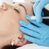 Mezoterapia igłowa Jalupro Young Eye – redukcja cieni i obrzęków pod oczami