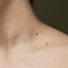 side-view-skin-texture-with-moles-scaled-1