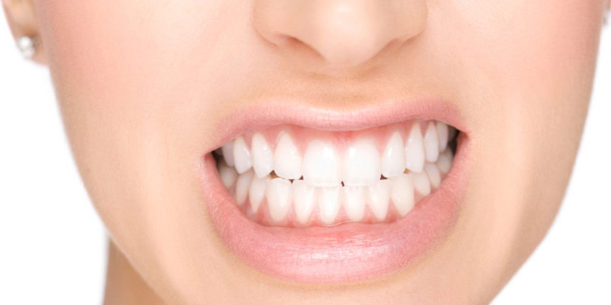 tratamiento-del-bruxismo-2